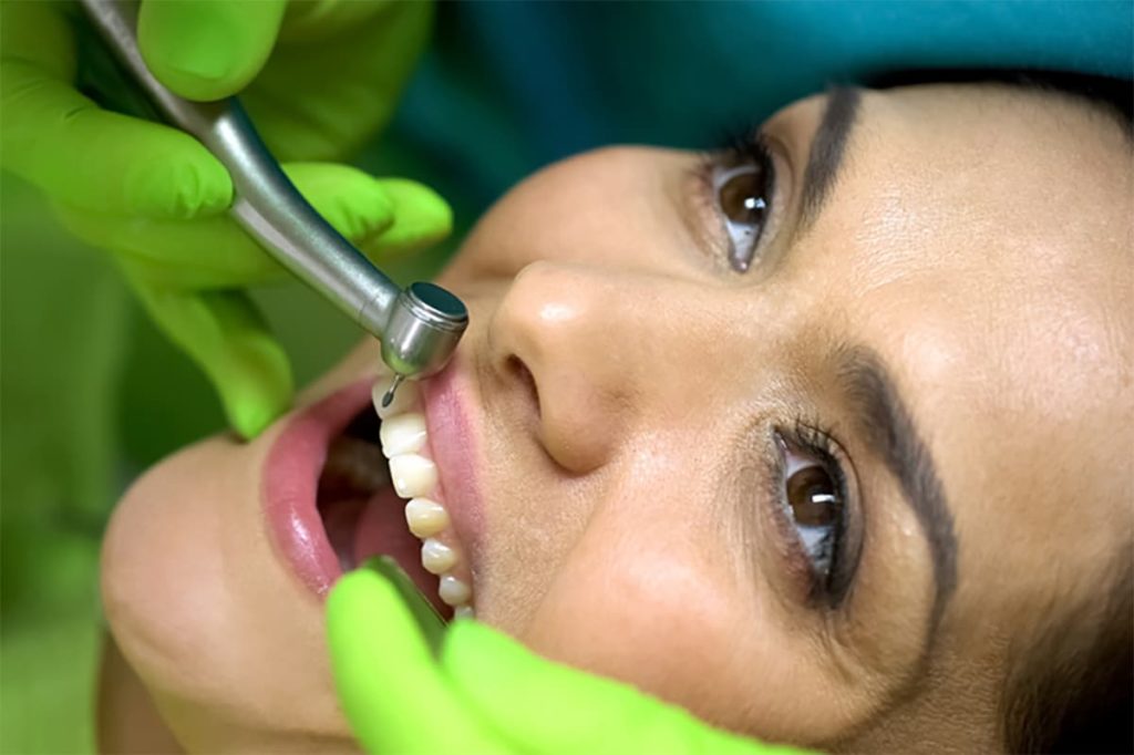 How Full Mouth Rehabilitation Restores Your Smile | Confidental